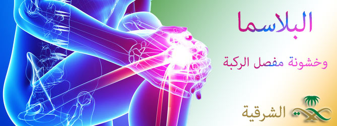 Arthritis