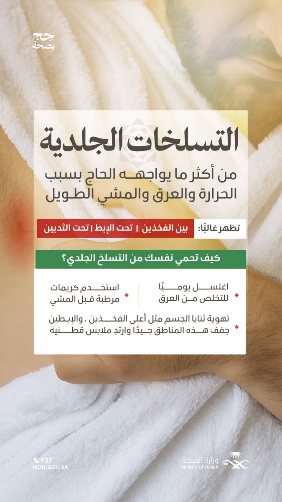 كمل مناسكك بيُسر.. 
واتبع الاجراءات الوقائية لتتجنب التعرض للتسلخات الجلدية.

#حج_بصحة
#يسر_وطمأنينة
١٢